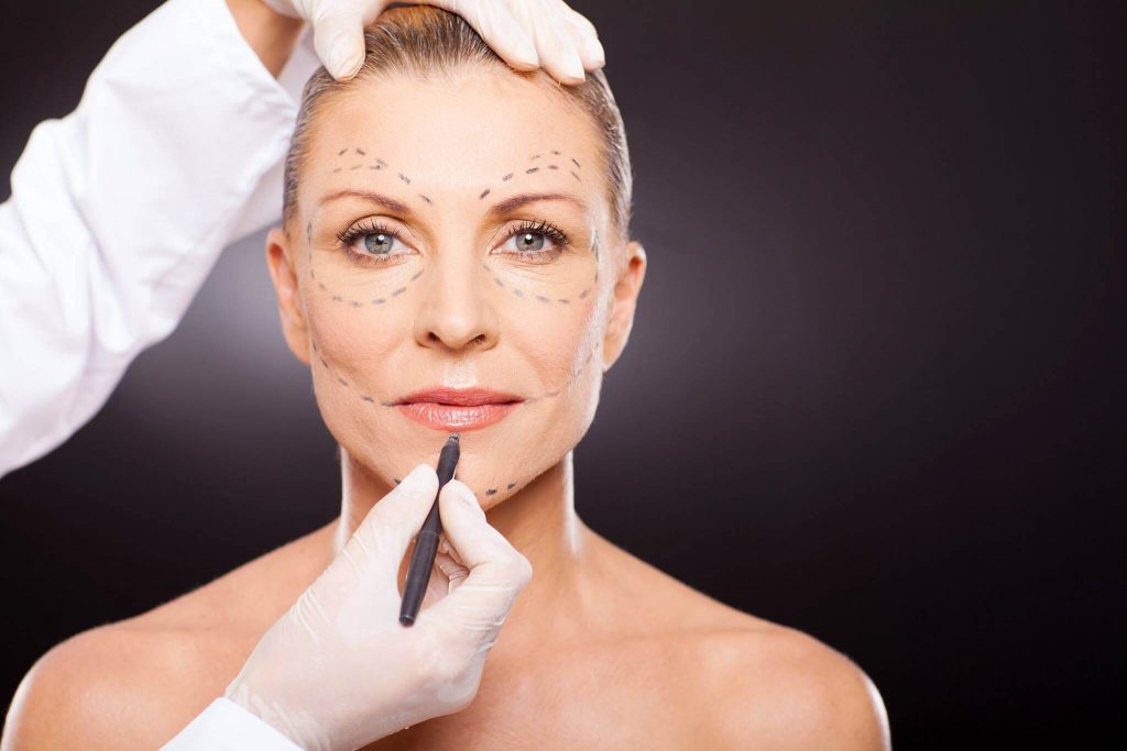 Facelift Findings: What to Expect From Facelift Surgery
