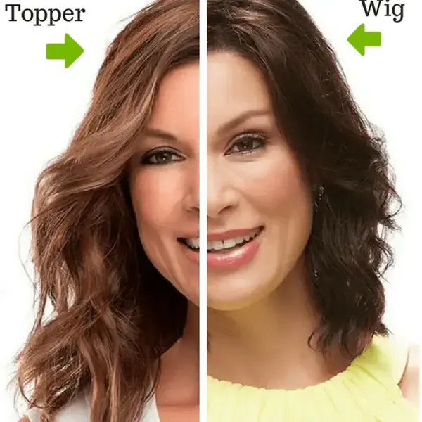 Hair topper vs. hair wig